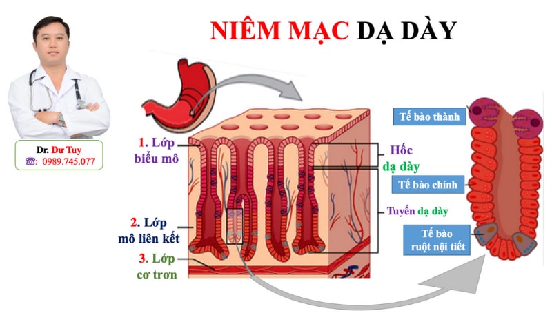 Viêm loét dạ dày nguyên nhân